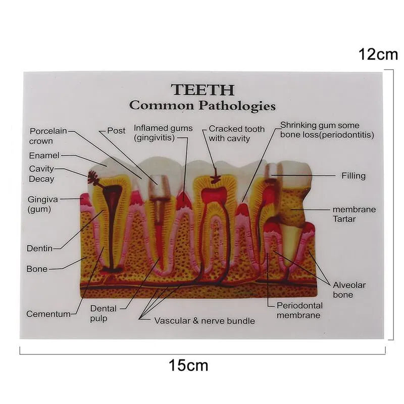 Trendzoy 1pcs Fully Anatomical Teeth Model For Studying Teaching Demonstration Dentist Dental Models For Patient Education Dentistry Products
