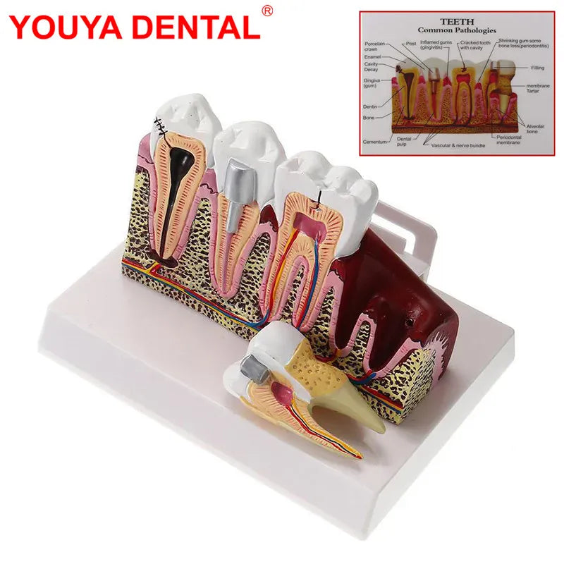 Trendzoy 1pcs Fully Anatomical Teeth Model For Studying Teaching Demonstration Dentist Dental Models For Patient Education Dentistry Products