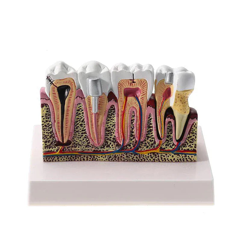 Trendzoy 1pcs Fully Anatomical Teeth Model For Studying Teaching Demonstration Dentist Dental Models For Patient Education Dentistry Products